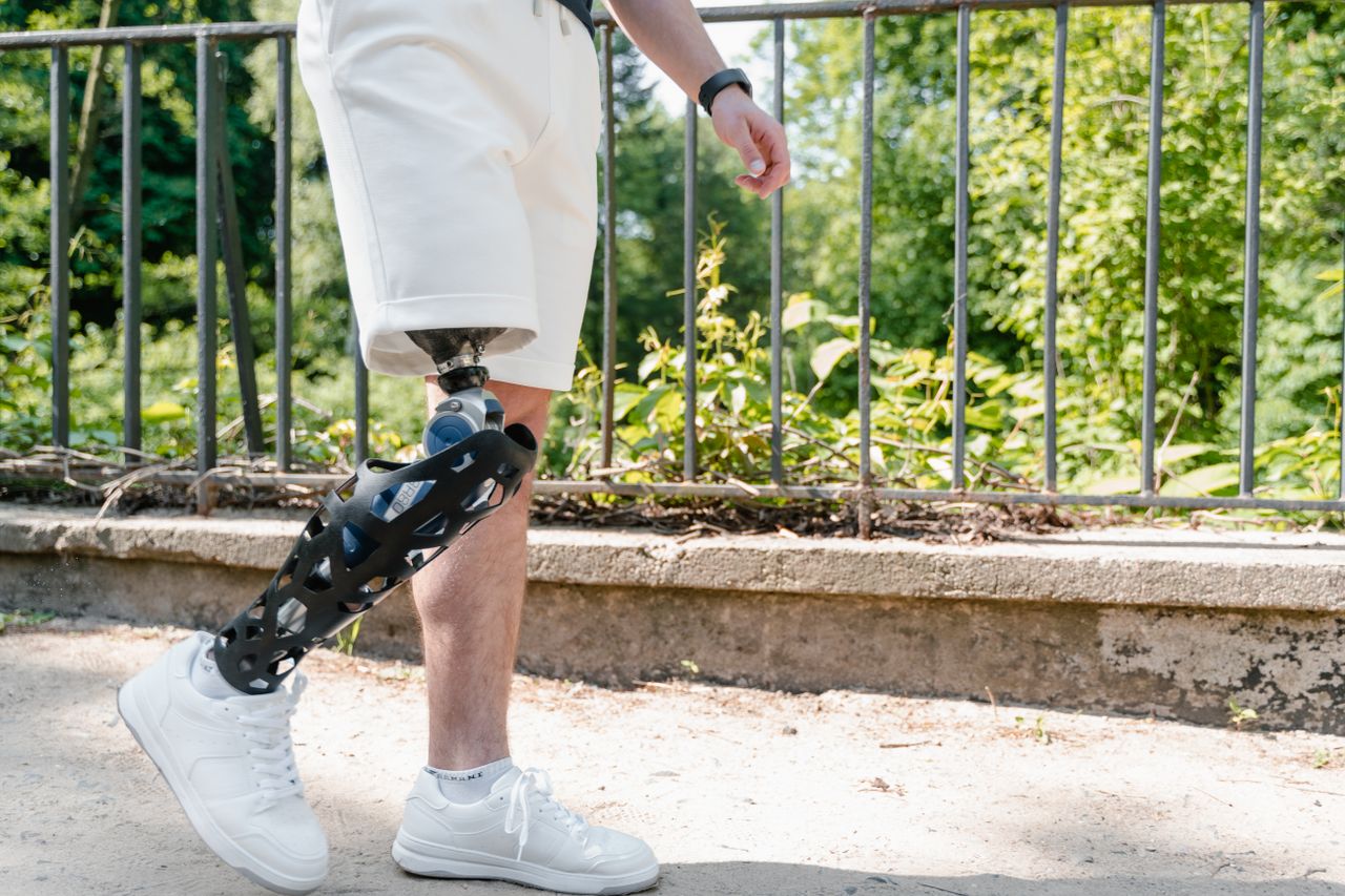 A person walking in a park with a modern prosthetic leg, wearing white shorts.